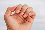 Nagelprothetik